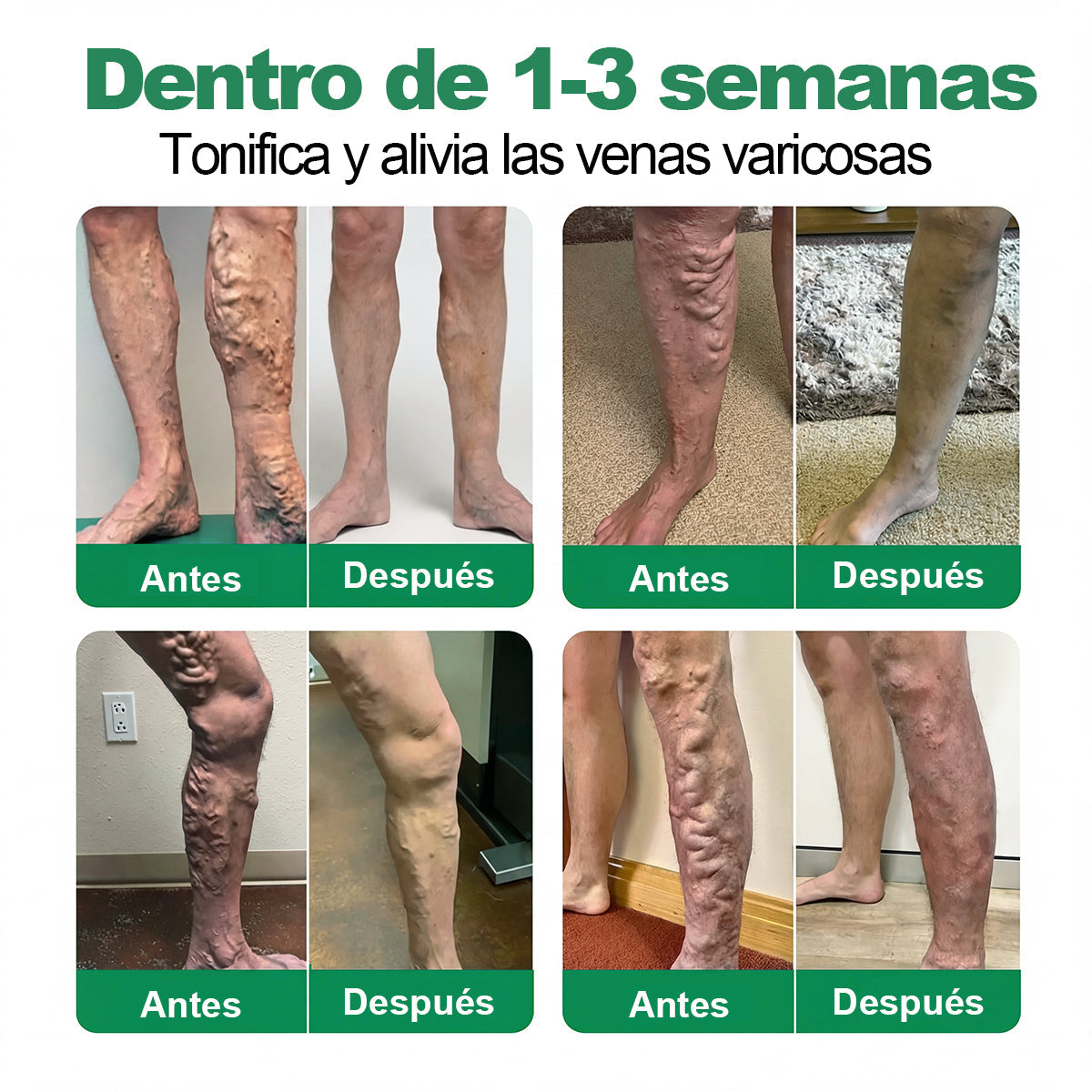 🇪🇸👨‍⚕️✅✅𝐂𝐨𝐚𝐮𝐨𝐨® 𝐏𝐚𝐫𝐜𝐡𝐞 𝐌𝐢𝐜𝐫𝐨𝐚𝐠𝐮𝐣𝐚𝐬 𝐏𝐚𝐫𝐚 𝐕𝐞𝐧𝐚𝐬⚡Alivio inmediato, resultados duraderos ¡Gran oferta!