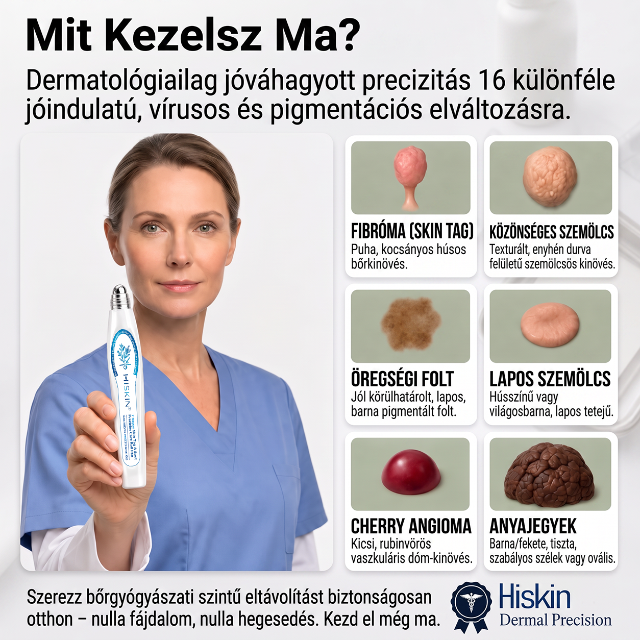 7 napos golyós aplikátor szemölcsök és foltok ellen – Fejlett, fájdalommentes és hegmentes bőrhibatartó megoldás