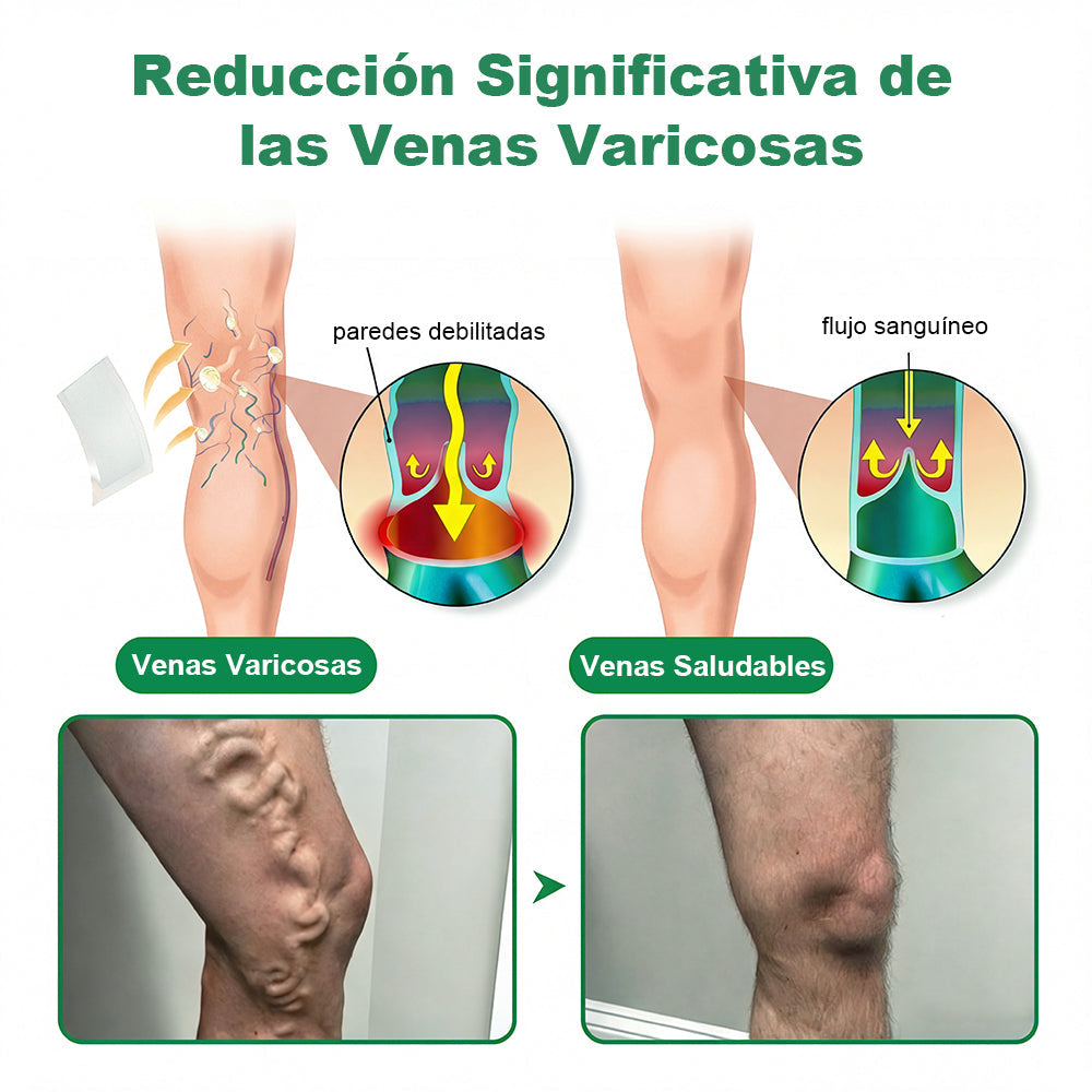🇪🇸👨‍⚕️✅✅𝐂𝐨𝐚𝐮𝐨𝐨® 𝐏𝐚𝐫𝐜𝐡𝐞 𝐌𝐢𝐜𝐫𝐨𝐚𝐠𝐮𝐣𝐚𝐬 𝐏𝐚𝐫𝐚 𝐕𝐞𝐧𝐚𝐬⚡Alivio inmediato, resultados duraderos ¡Gran oferta!