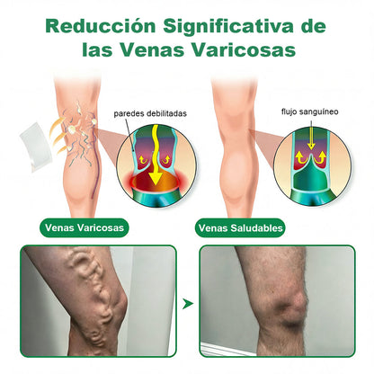 🇪🇸👨‍⚕️✅✅𝐂𝐨𝐚𝐮𝐨𝐨® 𝐏𝐚𝐫𝐜𝐡𝐞 𝐌𝐢𝐜𝐫𝐨𝐚𝐠𝐮𝐣𝐚𝐬 𝐏𝐚𝐫𝐚 𝐕𝐞𝐧𝐚𝐬⚡Alivio inmediato, resultados duraderos ¡Gran oferta!