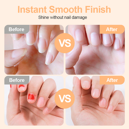 🥳2026 HOT SALE🥳💞50K+ SOLD! 🎁 50% OFF! 🔥2-in-1 Smart Electric Nail Trimmer & Polisher for All Ages 👨‍👩‍👧‍👦 💅